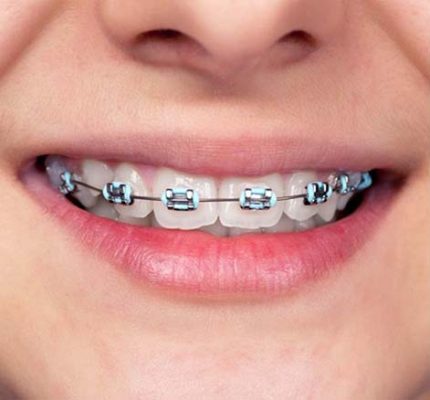 ارتودنسی کرج