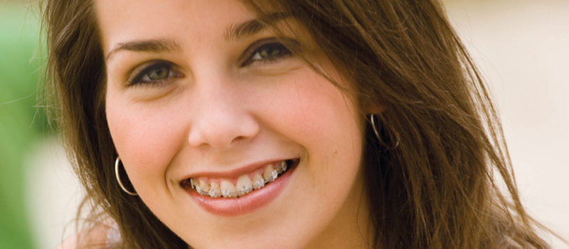 ارتودنسی بزرگسالان