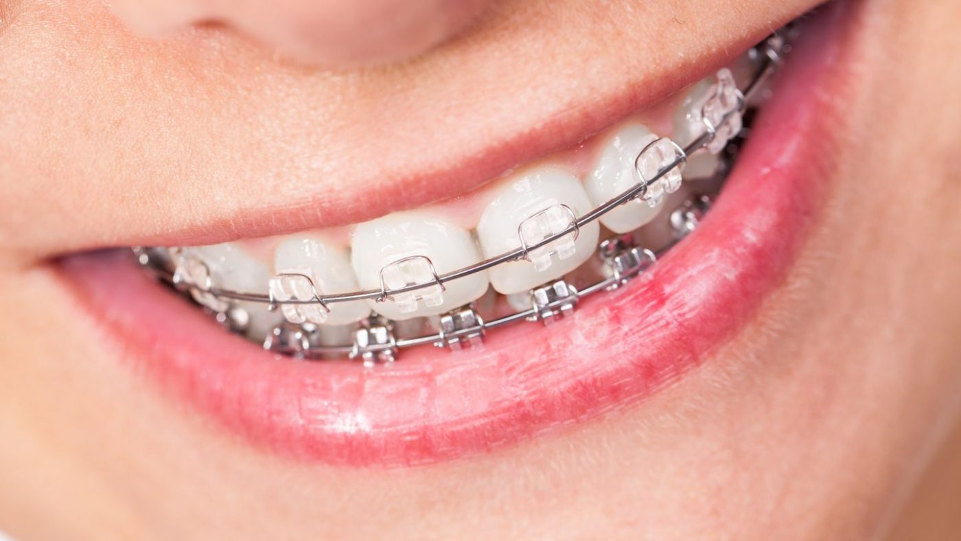 بهترین متخصص ارتودنسی در کرج