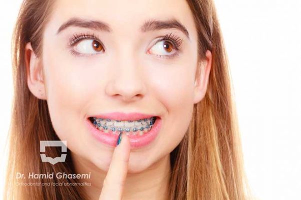 قیمت ارتودنسی در کرج