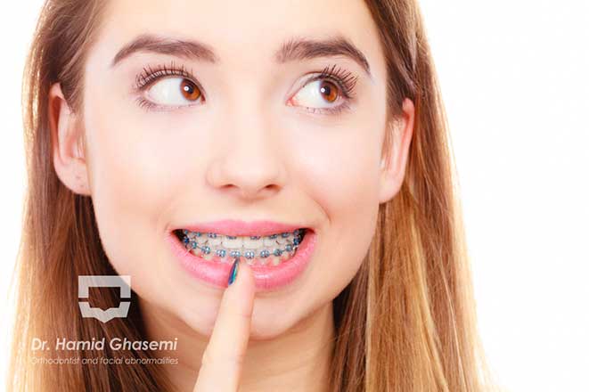 قیمت ارتودنسی در کرج