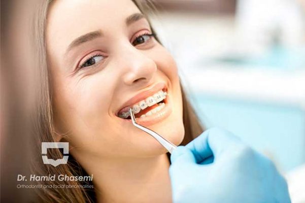 ارتودنسی اقساطی در کرج