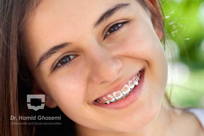 نباید ارتودنسی