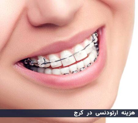 هزینه ارتودنسی در کرج